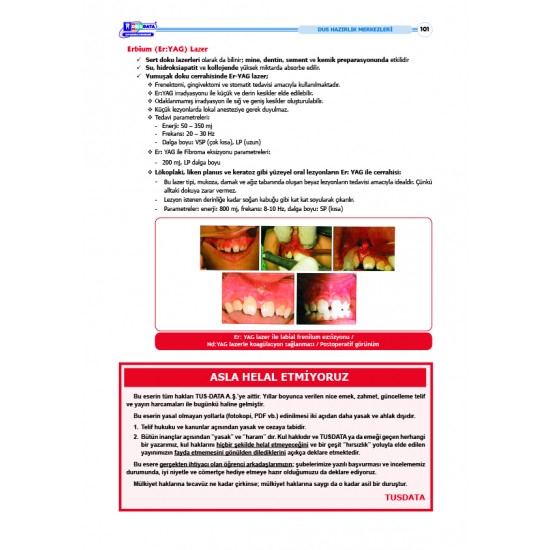 DUS Şampiyonların Notu ( 17.Baskı ) Ağız Cerrahisi