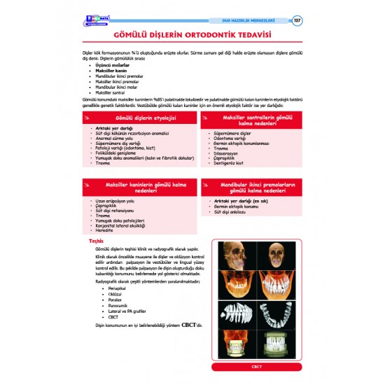 DUS Şampiyonların Notu ( 17.Baskı ) Ortodonti