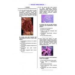 24 Açıklamalı Deneme Serisi 4.Baskı - Patoloji