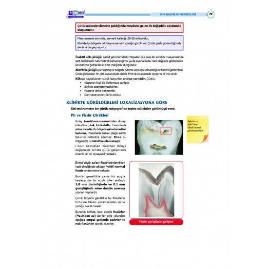 DUS Şampiyonların Notu ( 16.Baskı ) Restoratif Diş DUS Şampiyonların Notu ( 16.Baskı ) Restoratif Diş