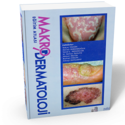 Makro Dermatoloji Eğitim Atlası - TÜZÜN