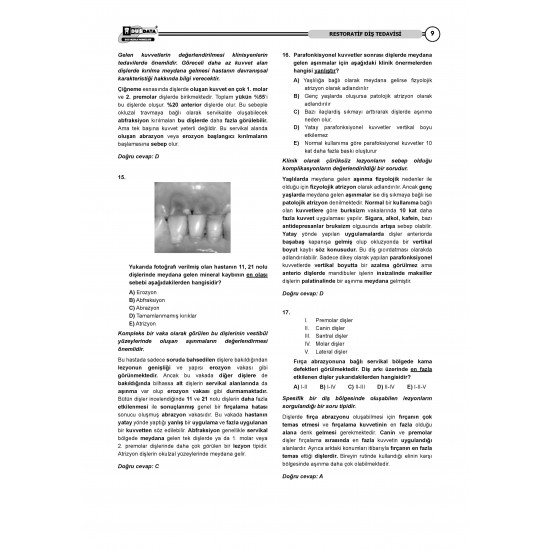DUS Vaka Kampı Soruları ( 2.Cilt ) Klinik Bilimler - 1 DUS Vaka Kampı Soruları ( 2.Cilt ) Klinik Bilimler - 1
