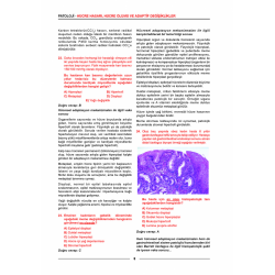 Meditus Patoloji Soruları ( 2.Baskı )