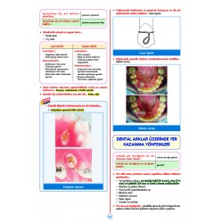 Rapidus Kampı ( 5.Baskı ) Ortodonti